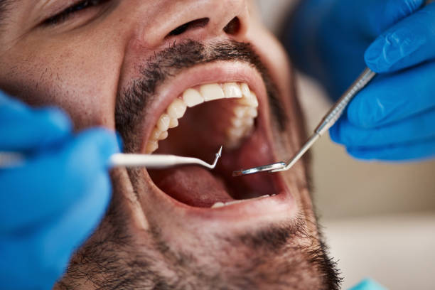 Best Orthodontic Emergency Dentist in Mexico, IN