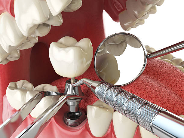 Best Emergency Dentist for Special Needs Patients in Mexico, IN